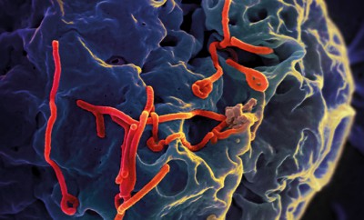 Zuverlässiger Impfstoff gegen Ebola