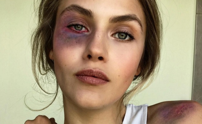 Germany's Next Topmodel: Elena Carriere schockt GNTM-Fans mit Instagram-Bild!