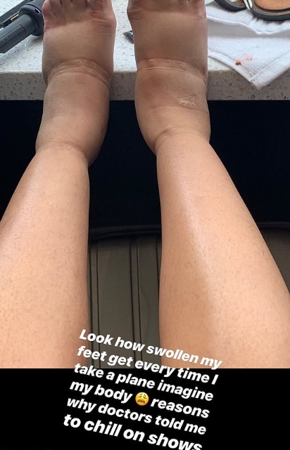 Cardi B postet Schock-Foto in ihrer Instagram Story.